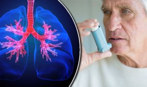 जाडो आउने क्रम सुरु हुँदैछ, दमका बिरामीले अहिलेदेखि के कुरामा ध्यान दिने?